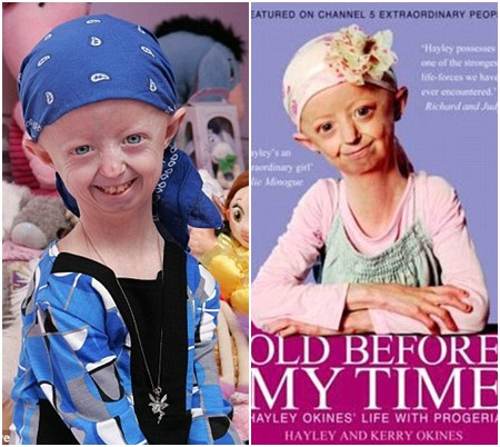 Cuốn sách của Hayley Okines