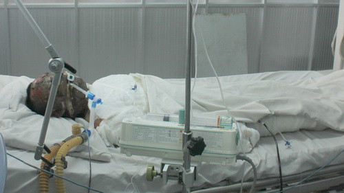 Tài xế Phan Đức Hòa được chăm sóc điều trị tại bệnh viện 175 sau vụ cháy xe vào ngày 11-1. Lúc 8g30 sáng nay 14-1, anh đã tử vong - Ảnh: Hoàng Lộc