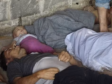 Một cậu bé mà các nhà hoạt động ở Syria cho rằng bị ngộ độc khí đang được thở ôxy ở vùng ngoại ô Saqba hôm 21/8. Ảnh: Mạng lưới tin tức Shaam