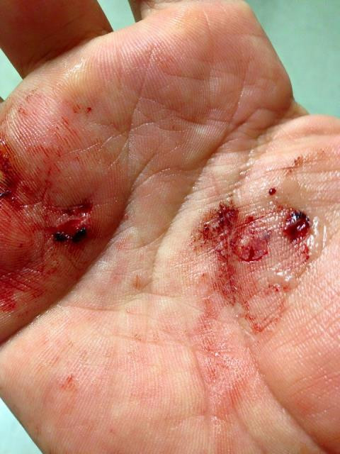 James gửi hình ảnh bị trầy xước bàn tay "đánh" vào tâm lý hay mủi lòng, nhẹ dạ của nạn nhân, mục đích để hối thúc nạn nhân chuyển tiền James gửi hình ảnh bị trầy xước bàn tay "đánh" vào tâm lý hay mủi lòng, nhẹ dạ của nạn nhân, mục đích để hối thúc nạn nhân chuyển tiền