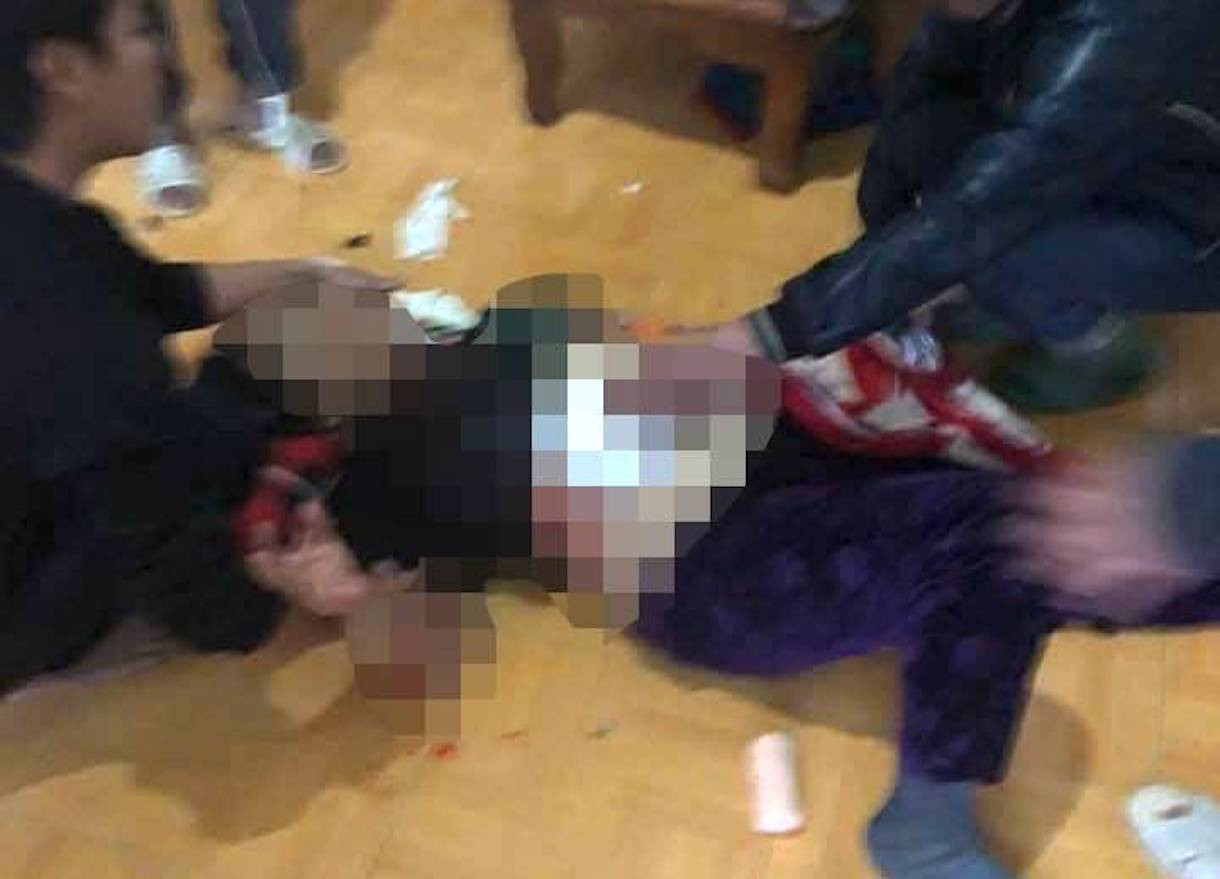 Người dân đến sơ cứu rồi đưa 2 nạn nhân đi bệnh viện cấp cứu trong tình trạng bị thủng bụng, lộ nội tạng ra ngoài.