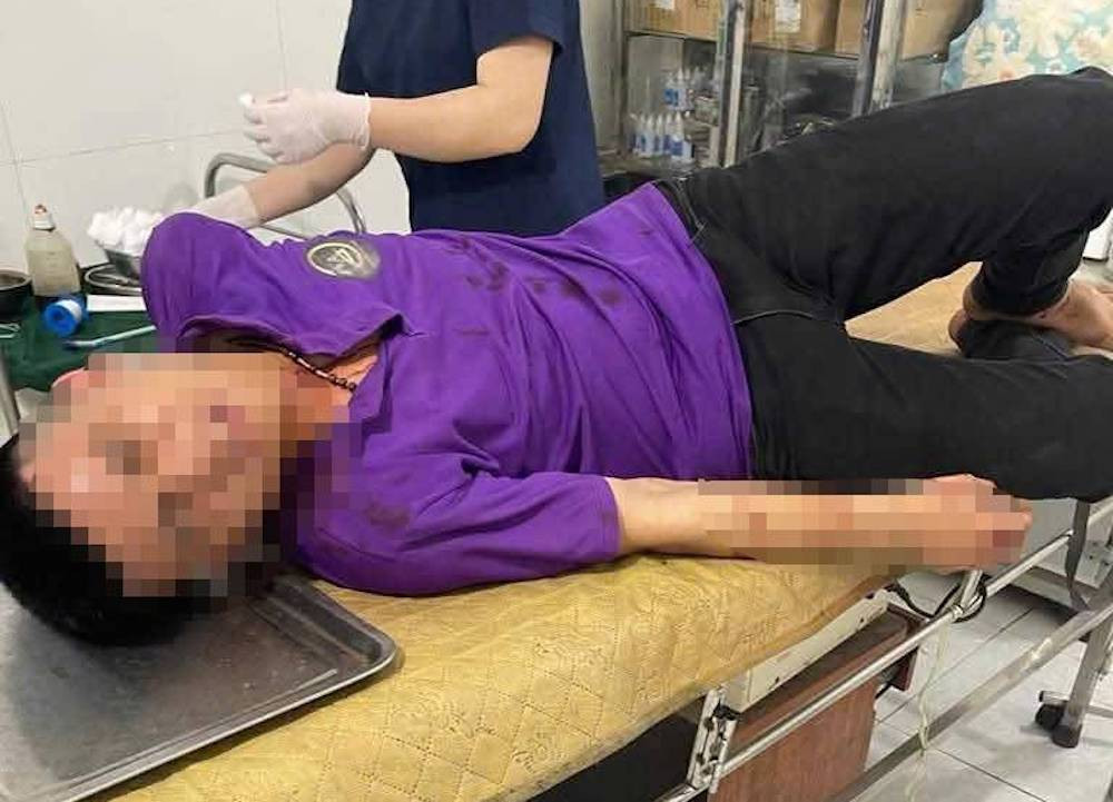 Vụ việc khiến tài xế và phụ xe khách Nam Quỳnh Anh bị chấn thương nặng vùng đầu, tay phải nhập viện cấp cứu. Vụ việc khiến tài xế và phụ xe khách Nam Quỳnh Anh bị chấn thương nặng vùng đầu, tay phải nhập viện cấp cứu.