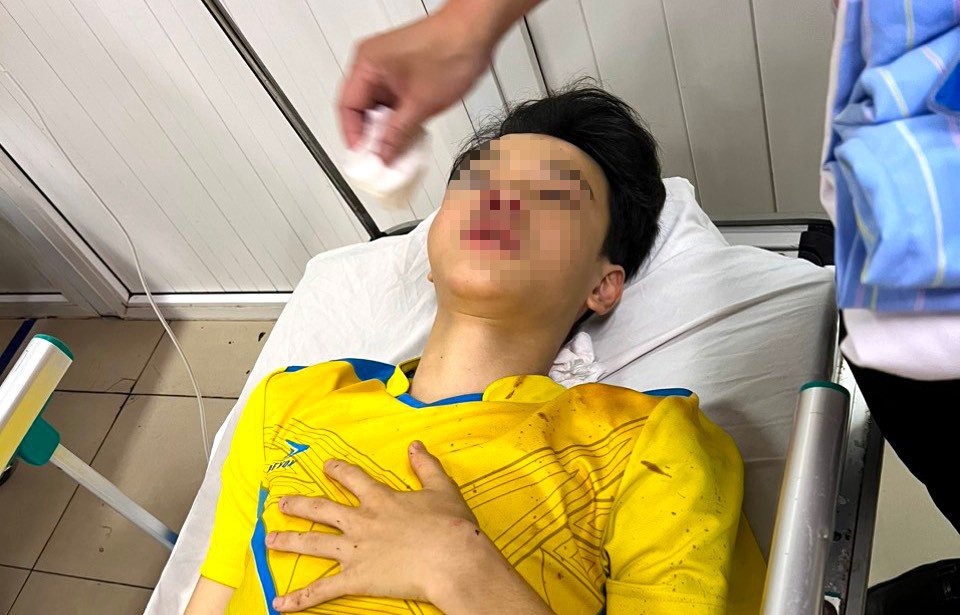 Trần Xuân Bảo Phúc bị thương nặng vùng mặt hiện đang được điều trị tại Bệnh viện đa khoa tỉnh Nghệ An. Trần Xuân Bảo Phúc bị thương nặng vùng mặt hiện đang được điều trị tại Bệnh viện đa khoa tỉnh Nghệ An.