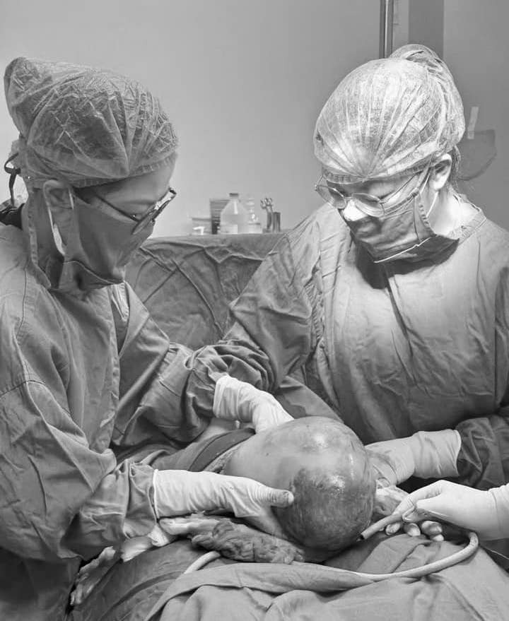 Các bác sĩ tiến hành phẫu thuật lấy thai cho sản phụ H. và bất ngờ khi cháu bé vẫn nằm nguyên trong bọc ối.