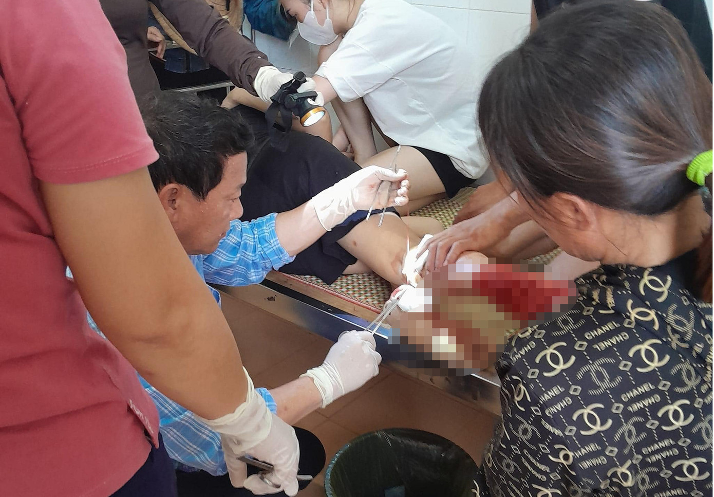 Con khỉ lạ cắn khiến một người phụ nữ bị thương ở chân. Con khỉ lạ cắn khiến một người phụ nữ bị thương ở chân.