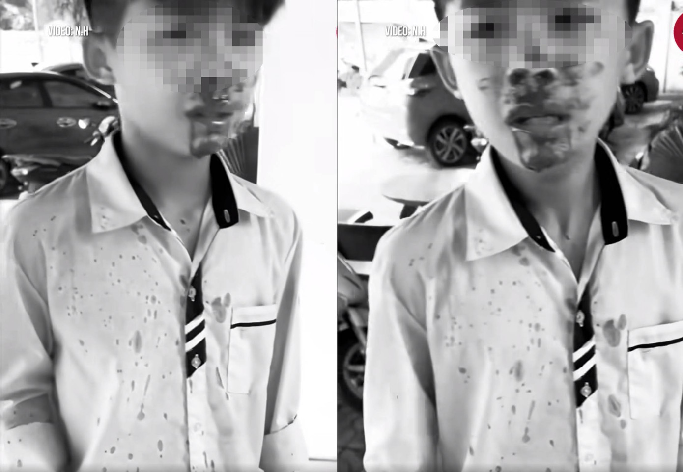 Nam sinh T. bị đánh khiến khuôn mặt đầy máu.