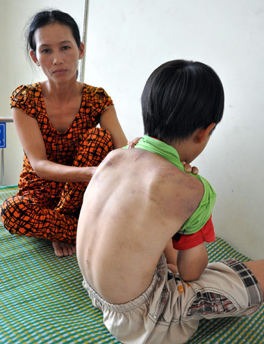 Bà Phan Thị Lên bên con trai Trần Tự bị chồng đánh tơi tả phải nhập viện cấp cứu