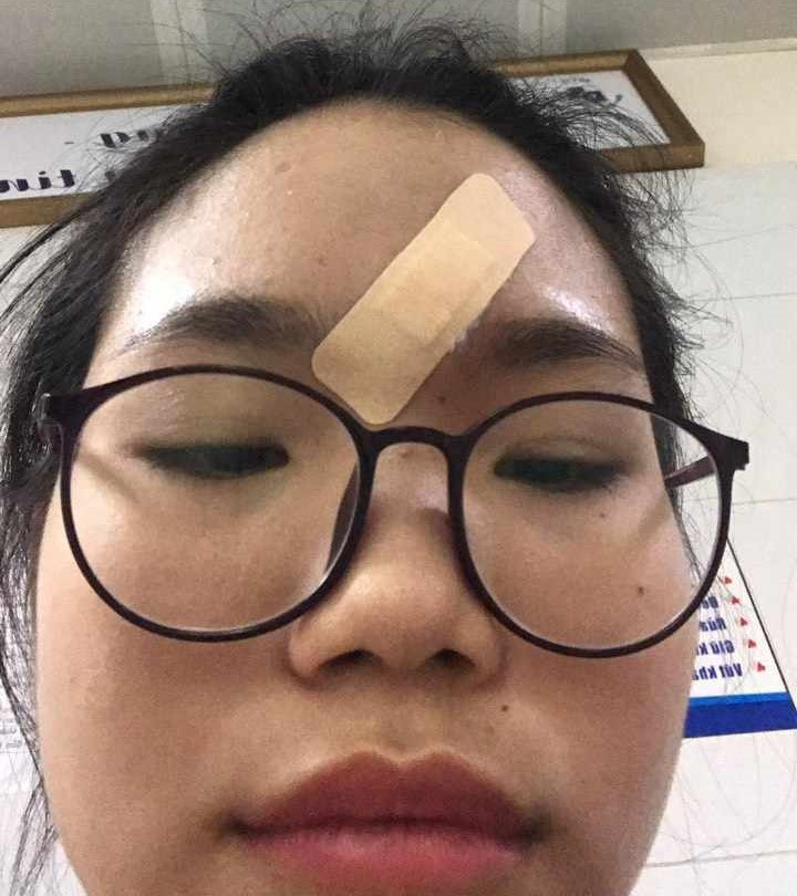 Gần đây, em Lộc Khánh Huyền thường xuyên bị chảy máu ở trán mà không có vết thương hở. Ảnh: Duy Chiến Gần đây, em Lộc Khánh Huyền thường xuyên bị chảy máu ở trán mà không có vết thương hở. Ảnh: Duy Chiến