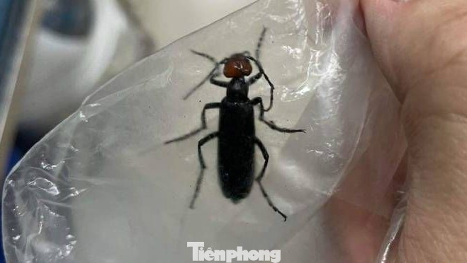 Côn trùng lạ có tên là sâu Ban Miêu rất độc. Ảnh: TL