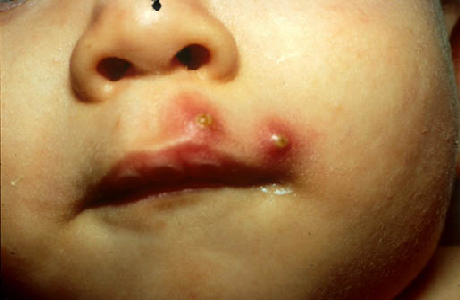 Con nhện - Vị thuốc tốt