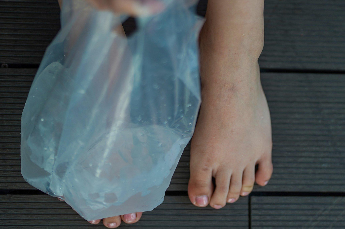 &quot;Chân tôi khá đau khi phải liên tục mang giày cao gót. Trong đêm chung khảo tôi chỉ cảm giác đau nhưng không ngờ lại sưng to đến vậy&quot;, Mai Chi nói.