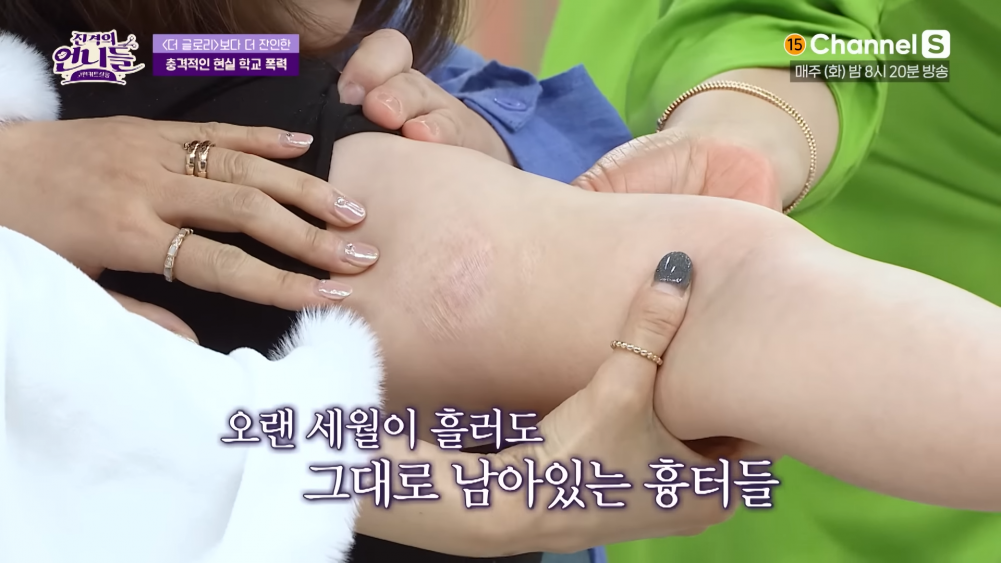 Nạn nhân khóc khi kể về tuổi thơ bị bạn bè bạo hành. Nạn nhân khóc khi kể về tuổi thơ bị bạn bè bạo hành.