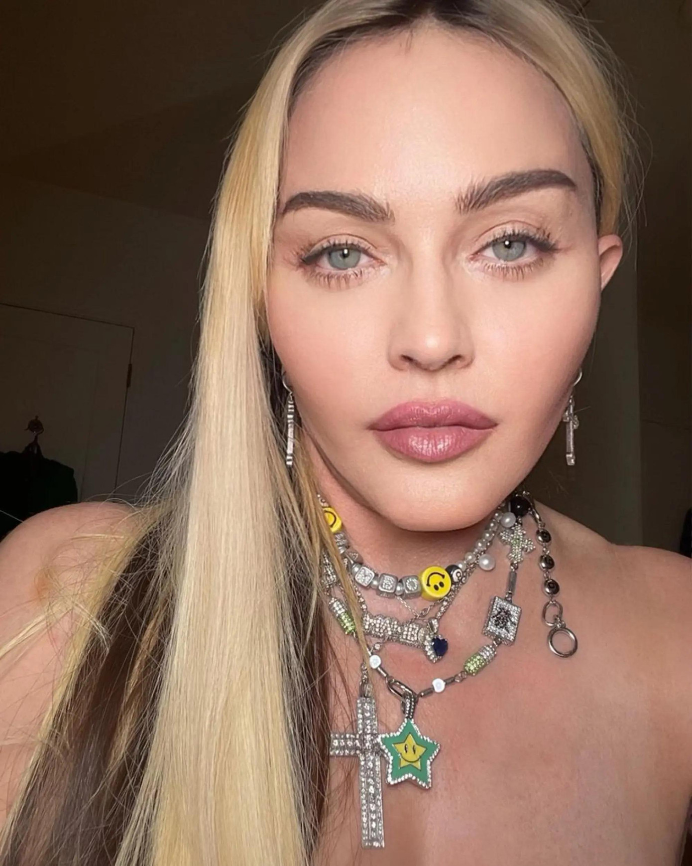 Gương mặt đơ cứng của Madonna do lạm dụng phẫu thuật thẩm mỹ. Ảnh: @madonna. Gương mặt đơ cứng của Madonna do lạm dụng phẫu thuật thẩm mỹ. Ảnh: @madonna.