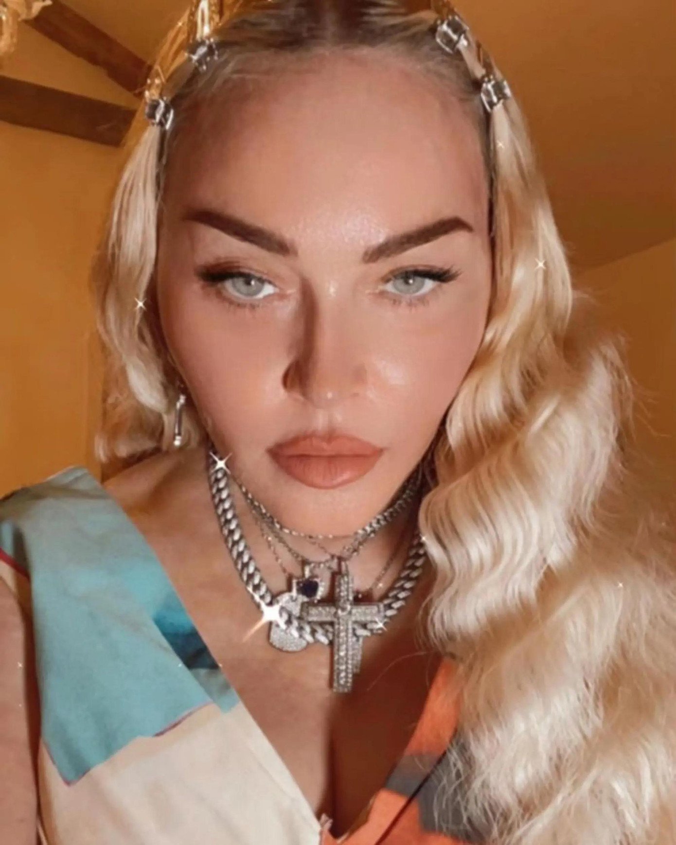 Gương mặt đơ cứng của Madonna do lạm dụng phẫu thuật thẩm mỹ. Ảnh: @madonna. Gương mặt đơ cứng của Madonna do lạm dụng phẫu thuật thẩm mỹ. Ảnh: @madonna.