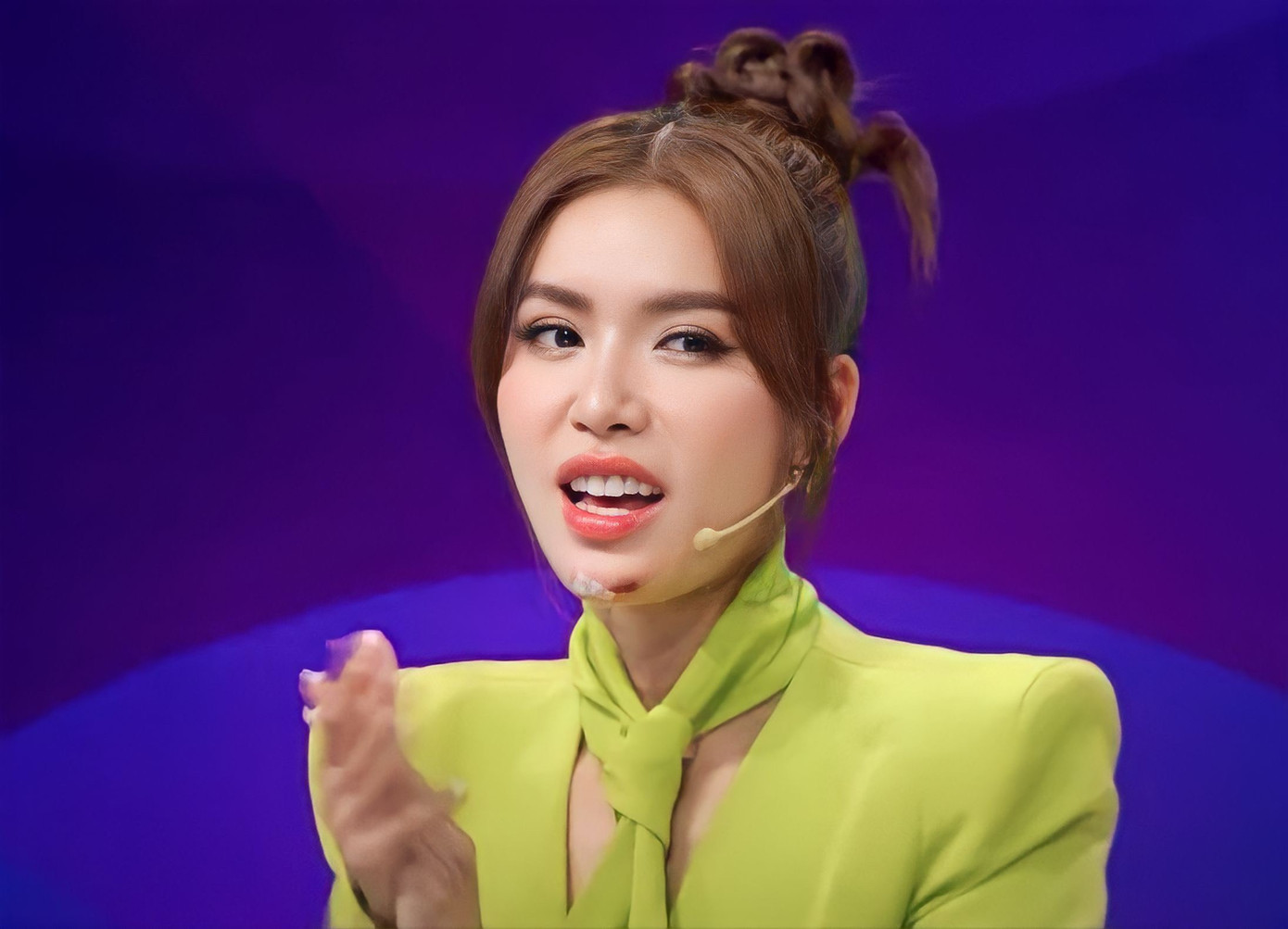 Minh Tú xuất hiện trên game show với vết thương dưới cằm. Minh Tú xuất hiện trên game show với vết thương dưới cằm.