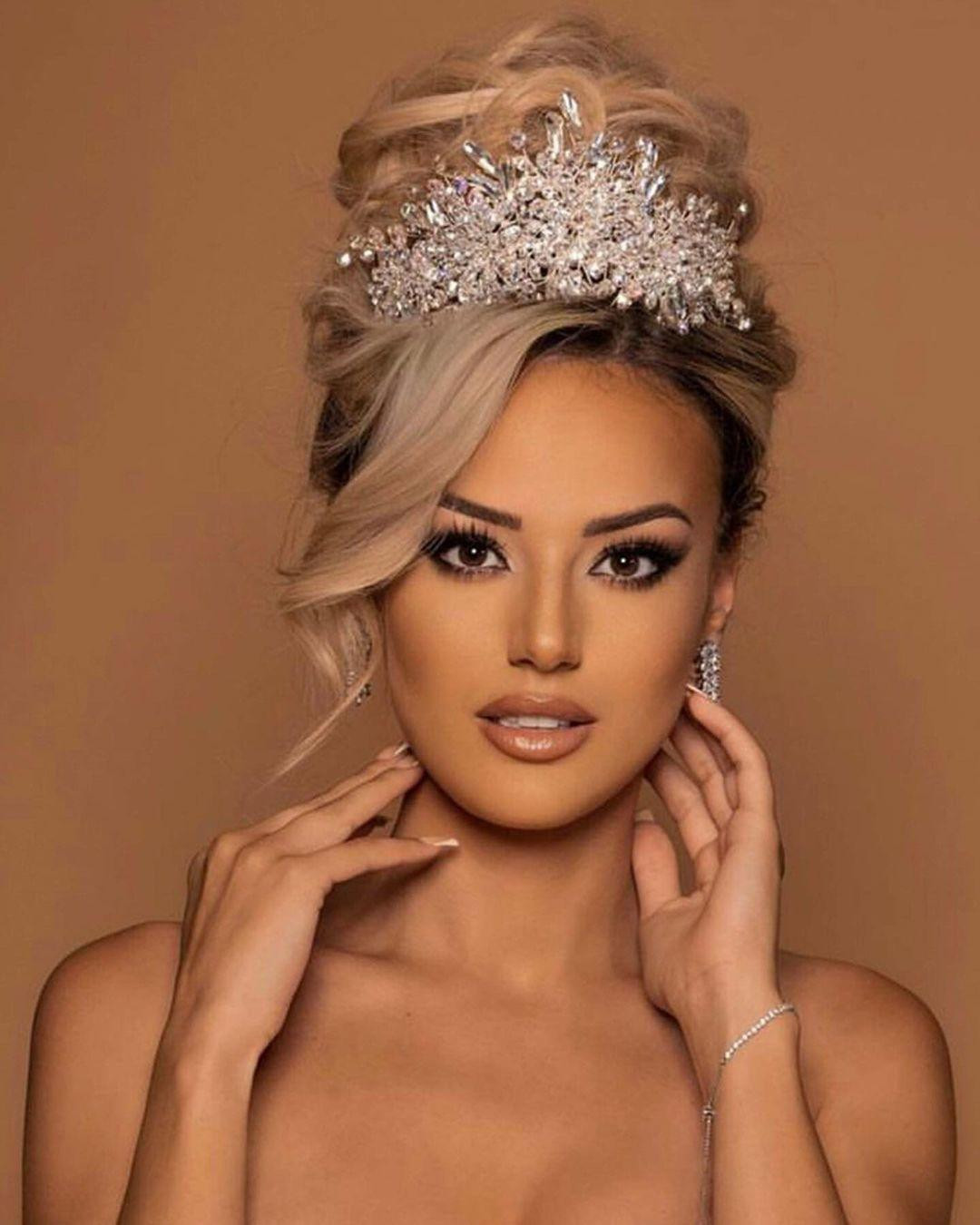 Edona Lie bỏ thi vì tình hình sức khỏe. Ảnh: MGI.