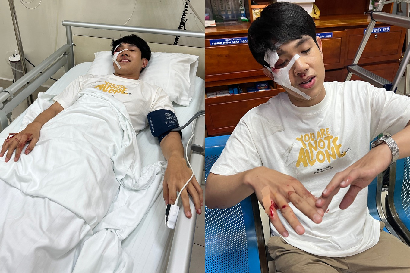 Long Hoàng bị tai nạn ảnh hưởng nghiêm trọng vùng mặt (Ảnh: Nhân vật cung cấp). Long Hoàng bị tai nạn ảnh hưởng nghiêm trọng vùng mặt (Ảnh: Nhân vật cung cấp).