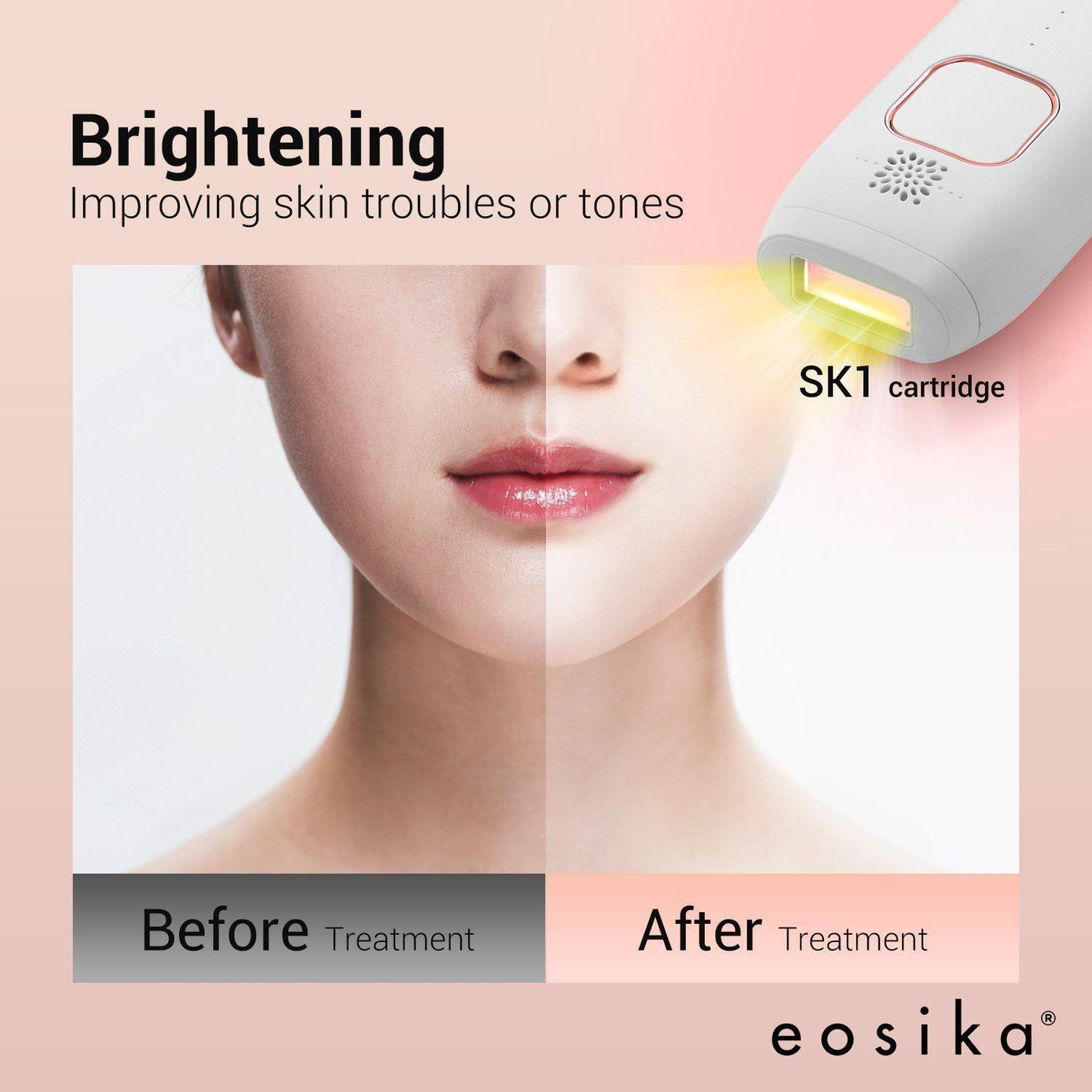 Không chỉ giúp triệt lông vĩnh viễn, SIPL-2000M còn có tác dụng cải thiện làn da trắng sáng, mịn màng