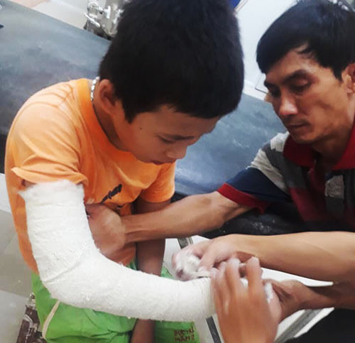 Bé trai trình báo bị tên cướp đánh gãy tay, lấy hết tiền bán vé số ảnh 1