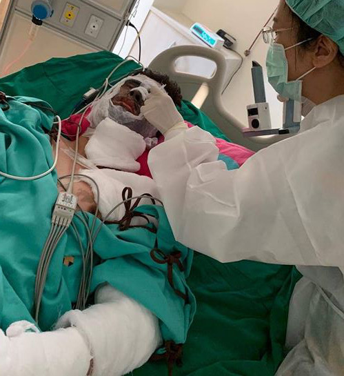 Vụ tạt axit, cắt gân chân Việt kiều: Bất ngờ lời kể của cha nạn nhân ảnh 3