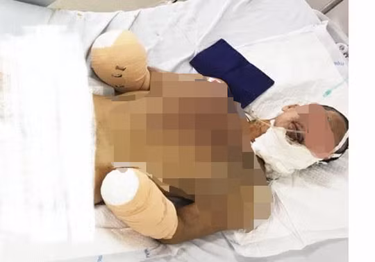 Pháo hoa nổ cạnh trụ sở công an: Lập hồ sơ xử lý 5 đối tượng ảnh 7 Pháo hoa nổ cạnh trụ sở công an: Lập hồ sơ xử lý 5 đối tượng ảnh 7