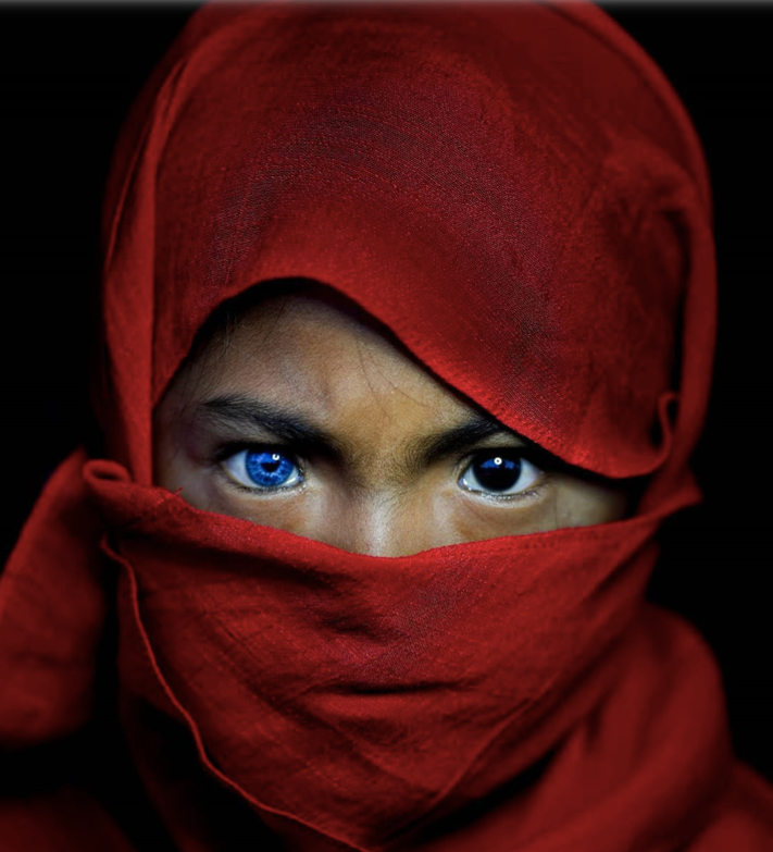 Cô bé có một bên mắt xanh, một bên mắt nâu