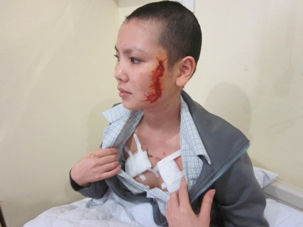 Chiều nay, bà chủ xăm rết lên mặt và ngực cô gái hầu tòa ảnh 2