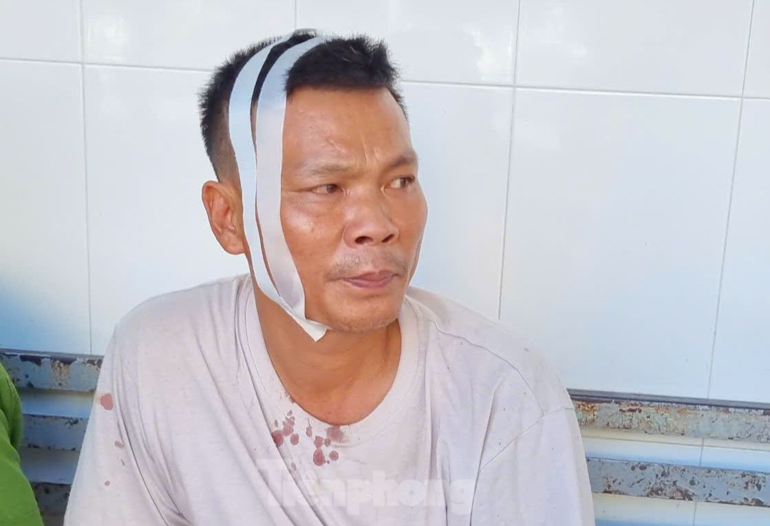 Anh Đỗ Đình Thiệu bị thương ở đầu và chân sau vụ tai nạn. Ảnh: Hoài Văn Anh Đỗ Đình Thiệu bị thương ở đầu và chân sau vụ tai nạn. Ảnh: Hoài Văn