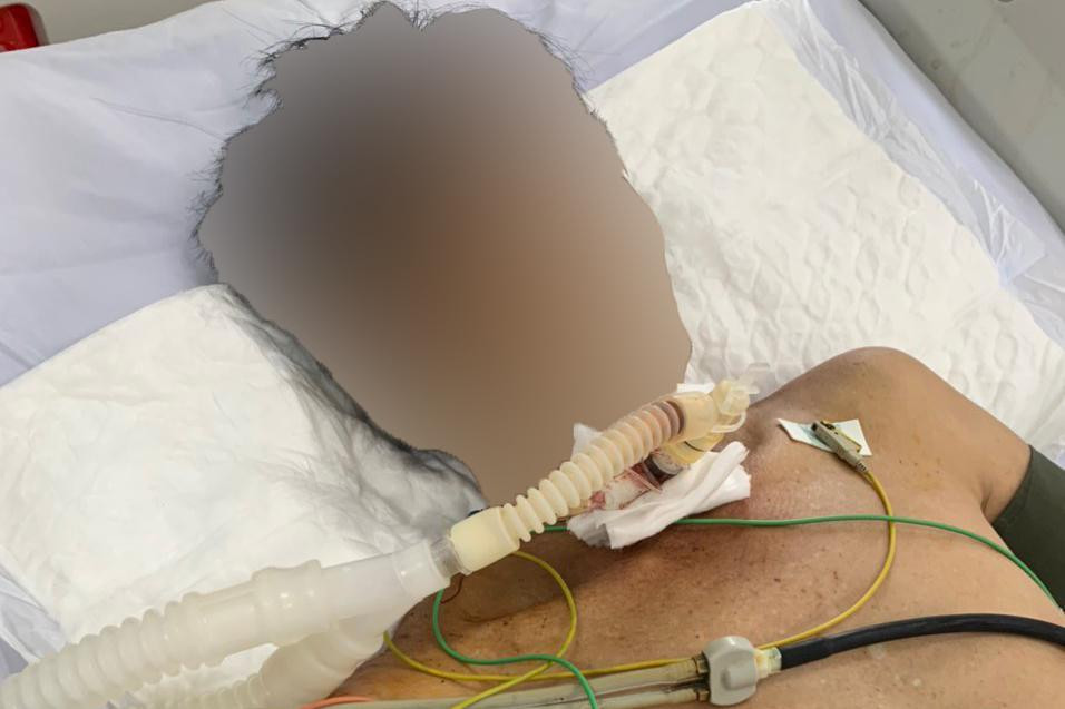 Người đàn ông dùng dao tự cứa cổ, đâm vào bụng mình được cấp cứu kịp thời. Ảnh BV