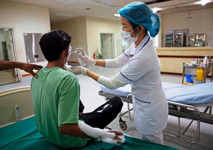 T. nhập viện với nhiều vết bỏng do điện thoại phát nổ. Ảnh BV