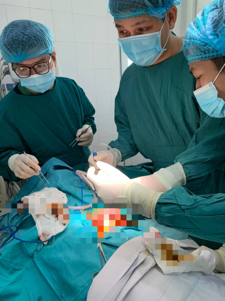 Bệnh nhân D. bị đứt lìa tay, dập phổi đang được cấp cứu. (Ảnh BV)