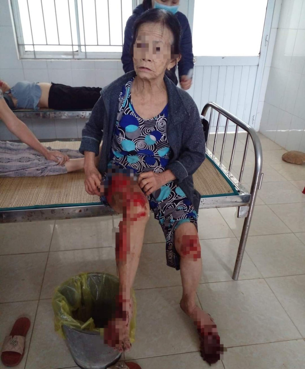 Bà H. bị thương ở chân sau khi bị kéo lê hàng chục mét trên đường.