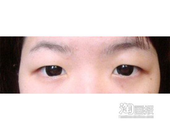 Hình ảnh đôi mắt một mí ban đầu không mấy bắt mắt