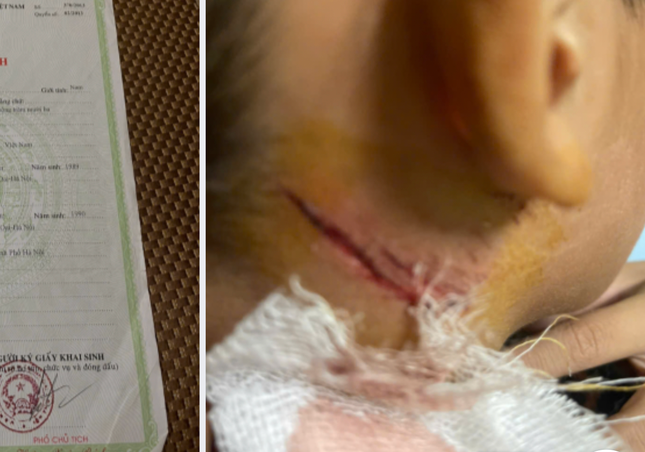 Cháu bé bị cứa cổ sau khi câu cá nhà hàng xóm. Cháu bé bị cứa cổ sau khi câu cá nhà hàng xóm.