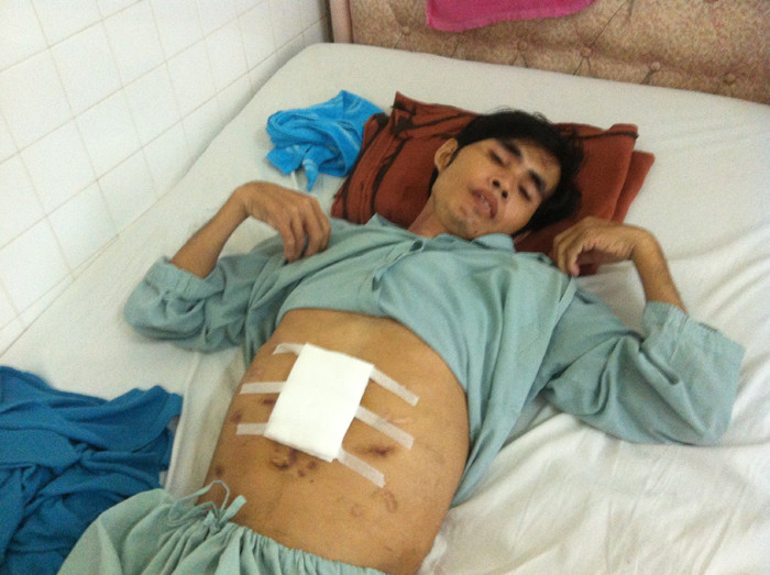 Người nhà cho rằng, bệnh nhân Trần Văn Hồ hiện bị cắt tụy, phải chạy thận nhân tạo là do lỗi từ Trung tâm y khoa Medic. Ảnh: L.N