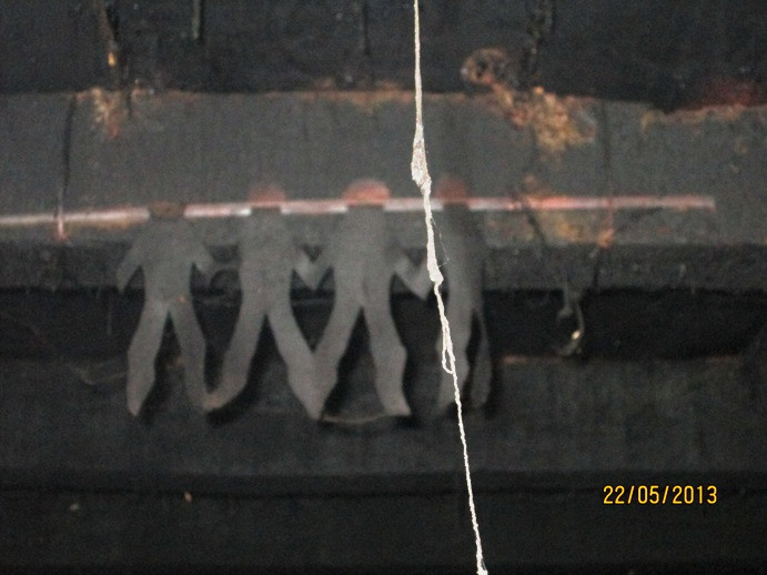 Họ bảo quản gìn giữ đến suốt cả cuộc đời. Nhiều người mất đi phần chân khi còn rất trẻ..