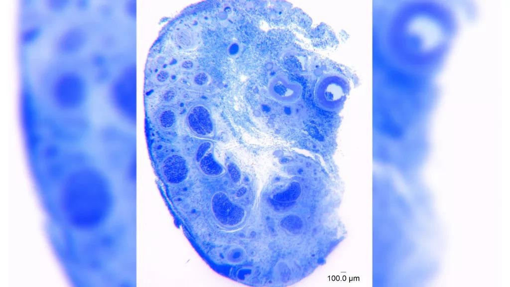 Hình ảnh mô học cho thấy một mặt cắt của mô âm vật, nhuộm màu xanh lam; các bó sợi thần kinh trông giống như các cụm chấm màu xanh lam Hình ảnh mô học cho thấy một mặt cắt của mô âm vật, nhuộm màu xanh lam; các bó sợi thần kinh trông giống như các cụm chấm màu xanh lam