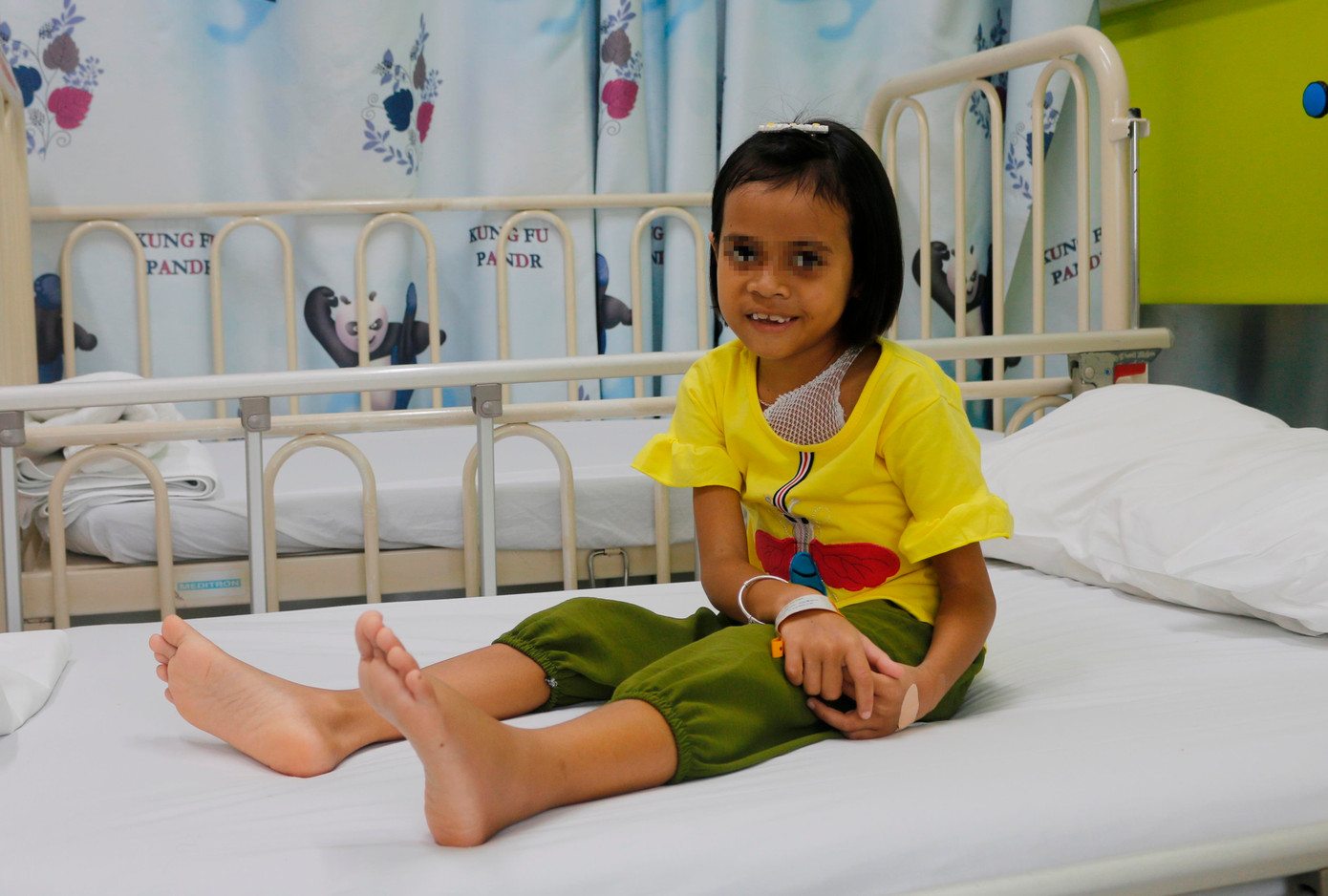 Phẫu thuật thành công cho bé gái 8 năm cõng khối bướu 4 kg trên lưng ảnh 2