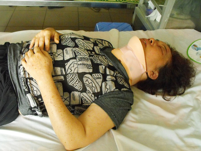 Bà Lê Thị Liên đang phải điều trị ở Bệnh viện Thanh Nhàn. Bà Lê Thị Liên đang phải điều trị ở Bệnh viện Thanh Nhàn