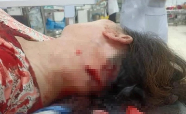 Chị P.T.H đang được điều trị tại Bệnh viện đa khoa tỉnh Thanh Hoá Chị P.T.H đang được điều trị tại Bệnh viện đa khoa tỉnh Thanh Hoá