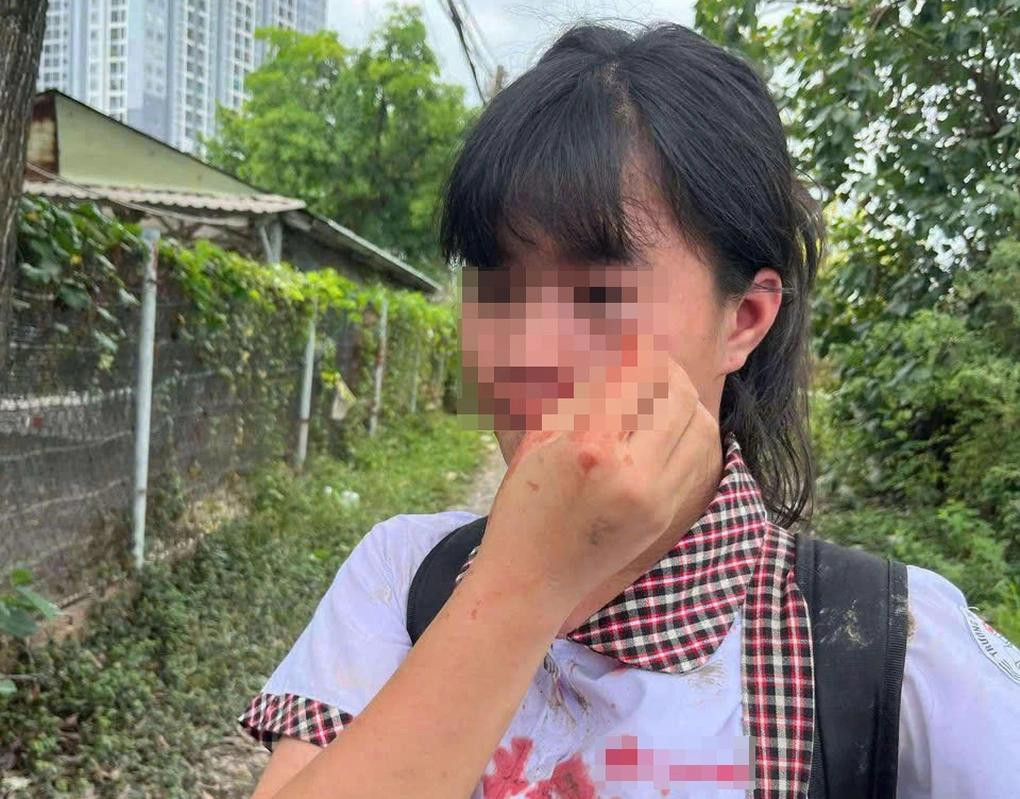 Nữ sinh bị nhóm người đánh đến bê bết máu. Ảnh: T.T. Nữ sinh bị nhóm người đánh đến bê bết máu. Ảnh: T.T.