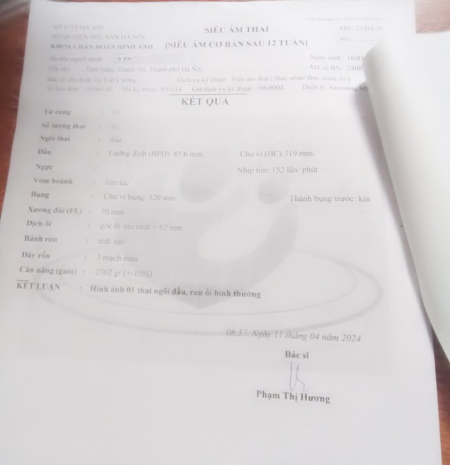 Kết quả siêu âm của bé Y. ngày 11/4/2024