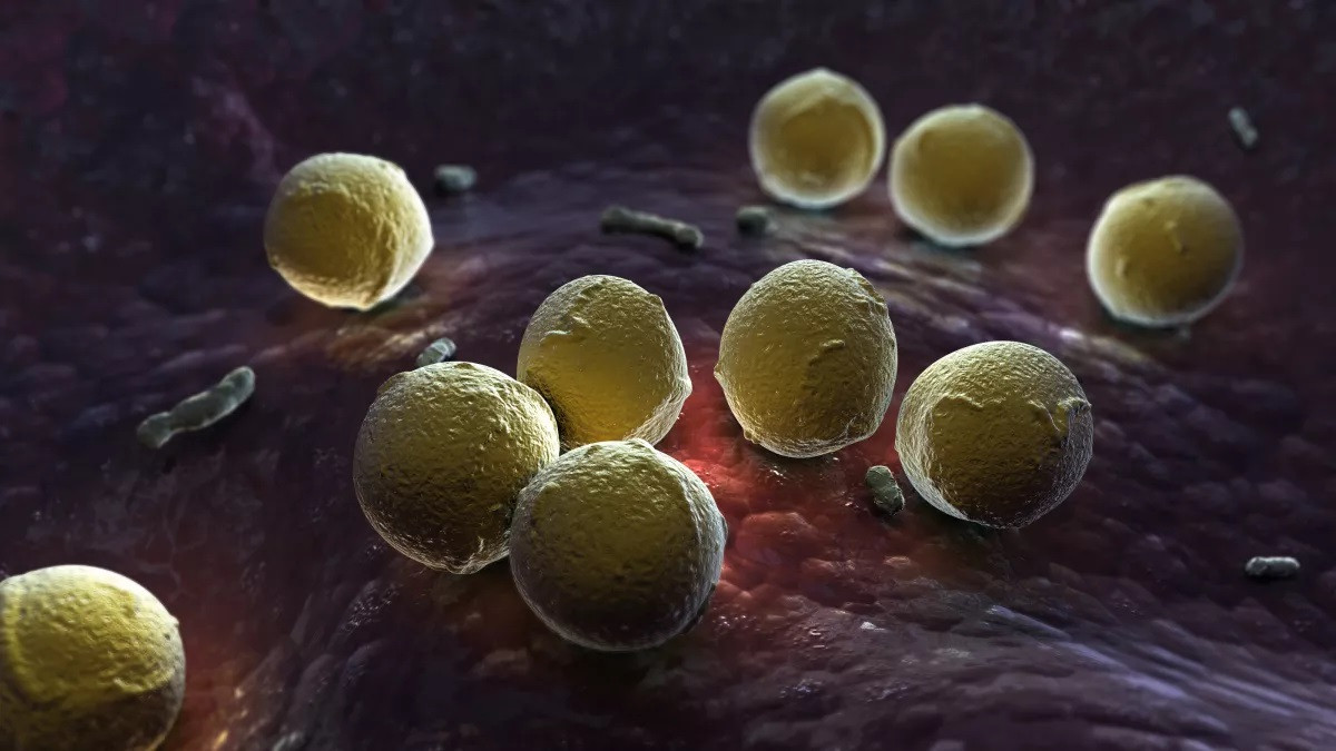 Hình minh họa về vi khuẩn Streptococcus pyogenes , có thể gây hoại tử.(Ảnh: Shutterstock)