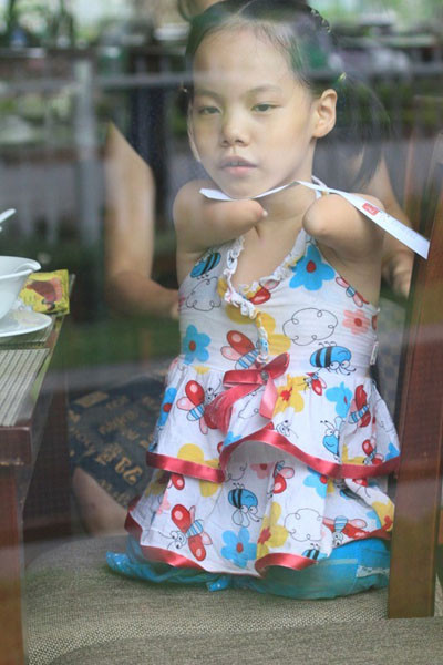 Linh Chi biết về Nick cách đây khá lâu và thường xem các clip trên mạng Youtube về cách Nick tập đi, tập ăn, tập viết, chơi thể thao..