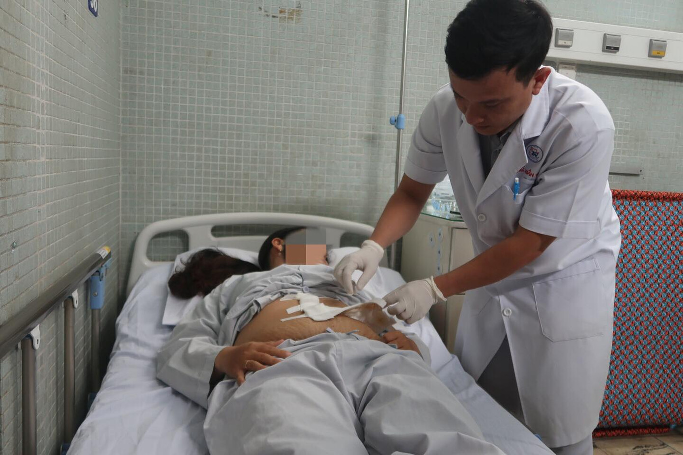 Lấy thành công khối đa nang lách dài nửa mét trong bụng người phụ nữ ảnh 1