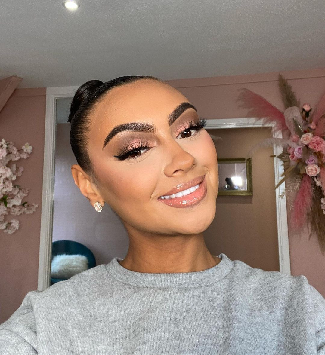 Darcey Corria tiết lộ bị hàng loạt chấn thương sau vụ tai nạn xe hơi nghiêm trọng.