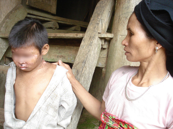 Em văn Thanh và mẹ