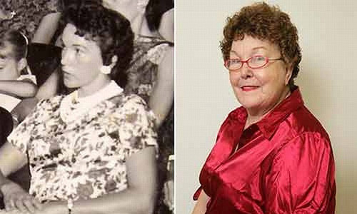 Phụ nữ đầu tiên nâng ngực: Năm 1962, bà nội trợ Timmie Jean Lindsey sống tại Texas, Mỹ là người đầu tiên thử nghiệm công nghệ nâng ngực bằng silicon