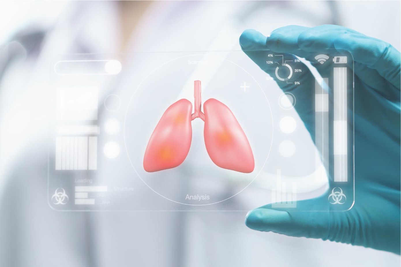 Căn bệnh ung thư phổ biến khác là ung thư gan với hơn 600.000 ca mắc vào năm 2018. Đặc biệt, ung thư gan có xu hướng tăng mạnh trong vài năm trở lại đây cùng tỉ lệ tử vong cao, chiếm 22,1% trong tổng số các trường hợp tử vong do ung thư.