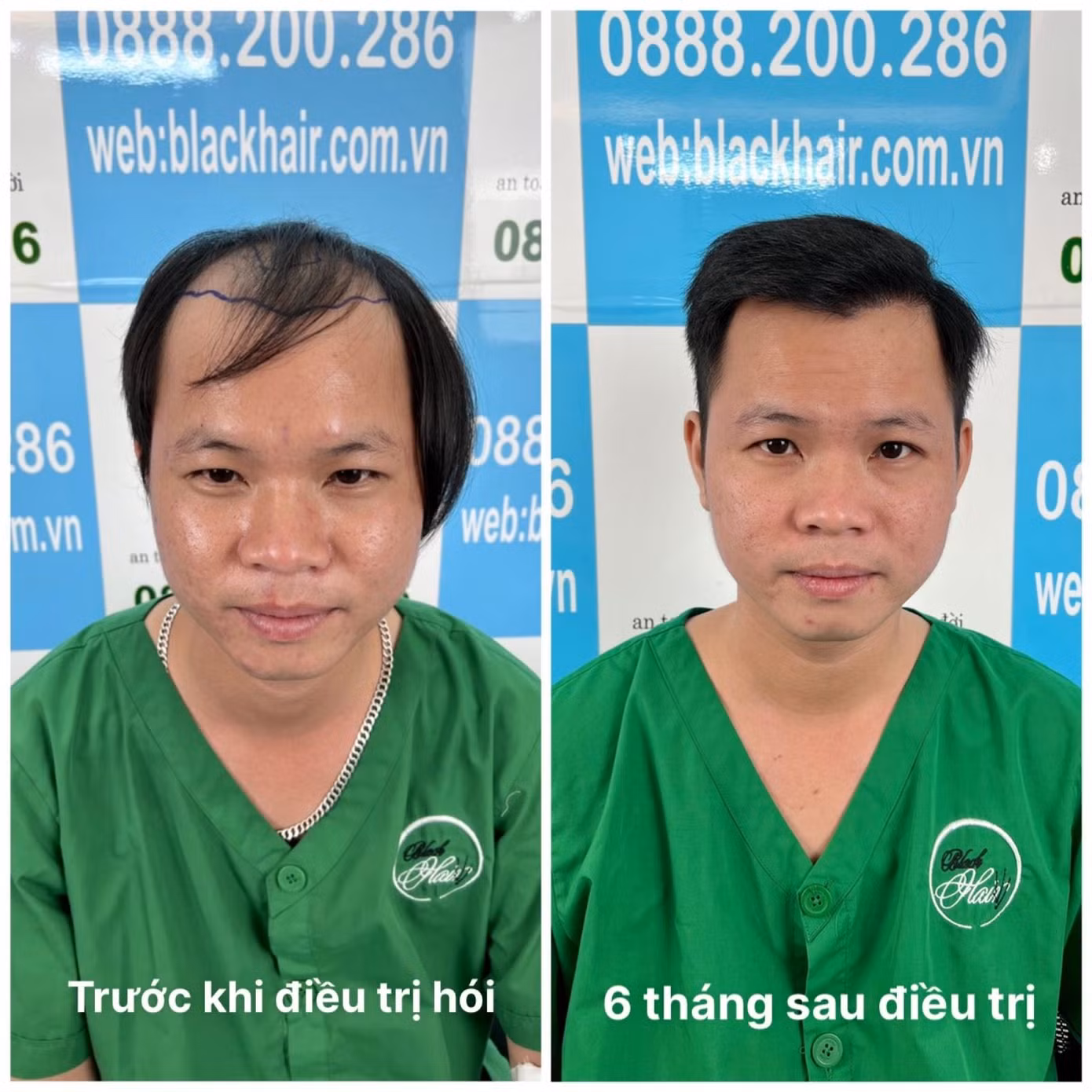 Phòng khám chuyên khoa điều trị chứng hói đầu, rụng tóc hiệu quả, được nhiều bệnh nhân tin tưởng.